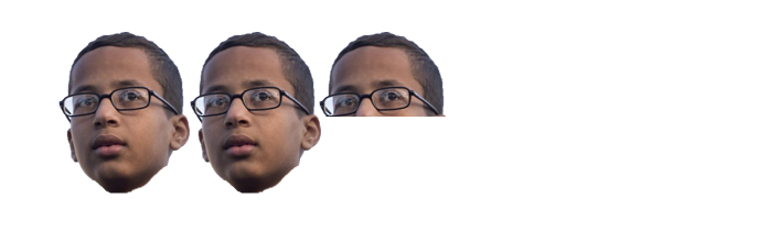 Ahmed scale