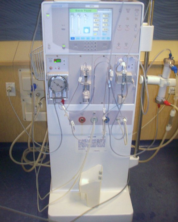 dialysis