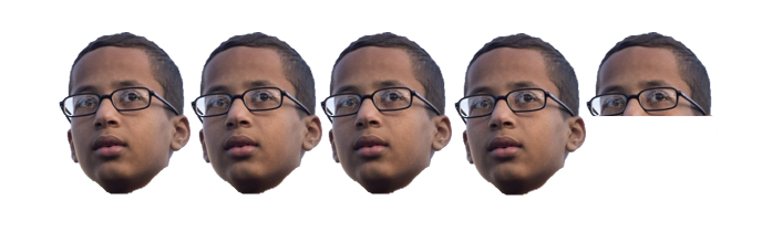 Ahmed Scale
