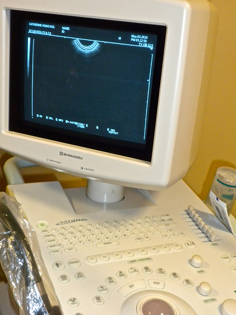 An ultrasound machine. 