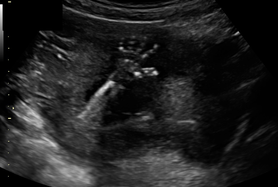 laura-perlongo-and-nev-schulman-share-sonogram