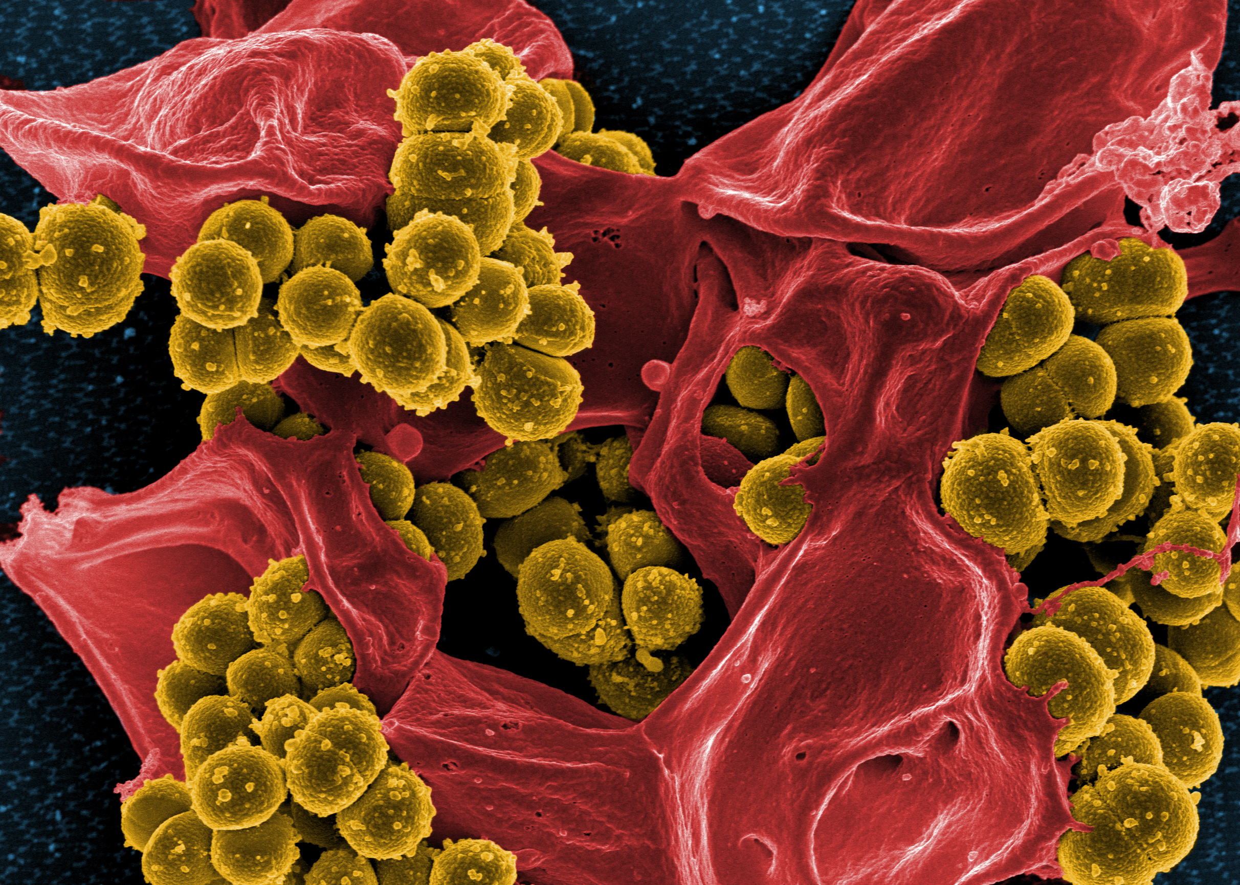 MRSA MRSA