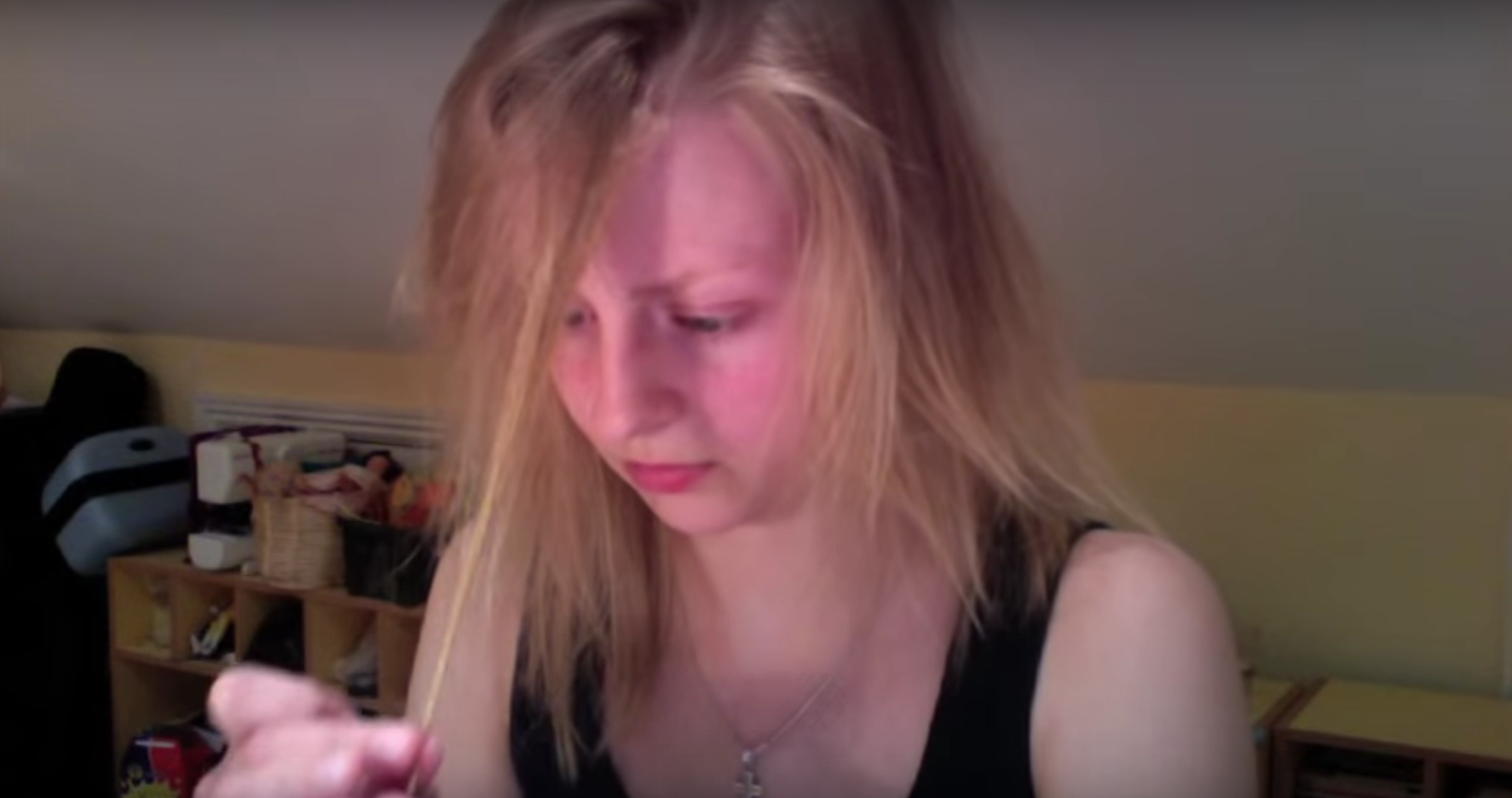 Beckie0 Trichotillomania