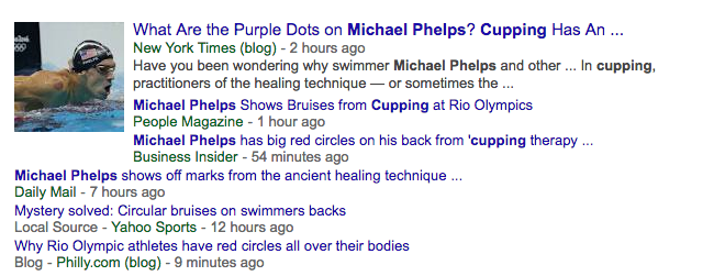 michael phelps cupping google results