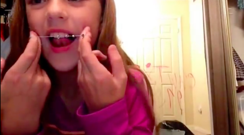 Teens Are Making And Wearing Fake Braces Attn - How To Make Diy Fake Braces