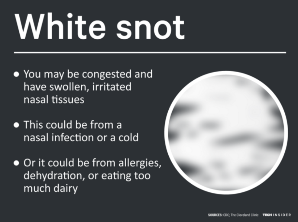 white snot info