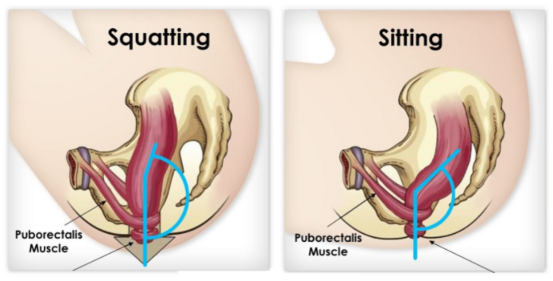 Why You Probably Shouldn't Sit Down When You Poop - ATTN: Why You Probably Shouldn't Sit Down When You Poop - ATTN: