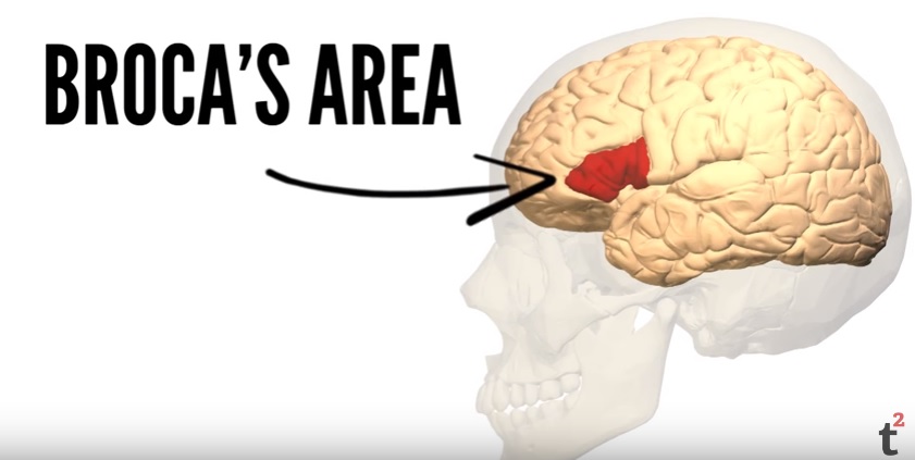 This is Broca's area. 