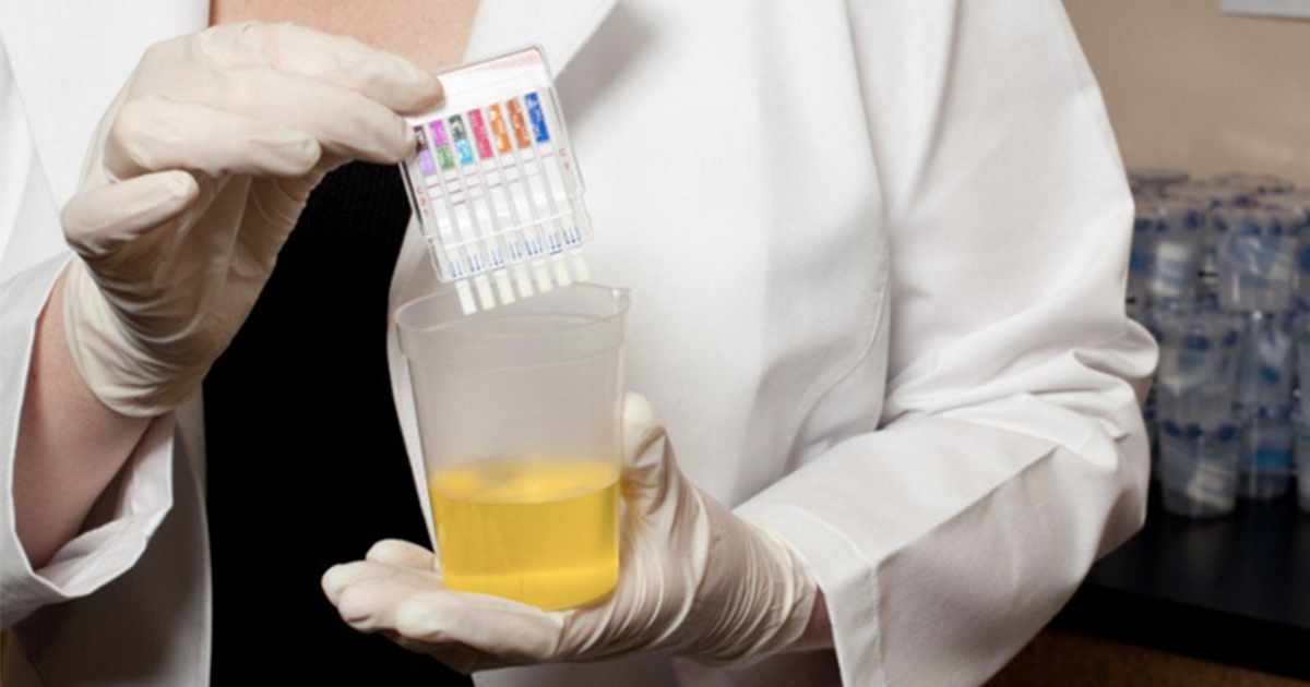 professional-drug-testing-urine
