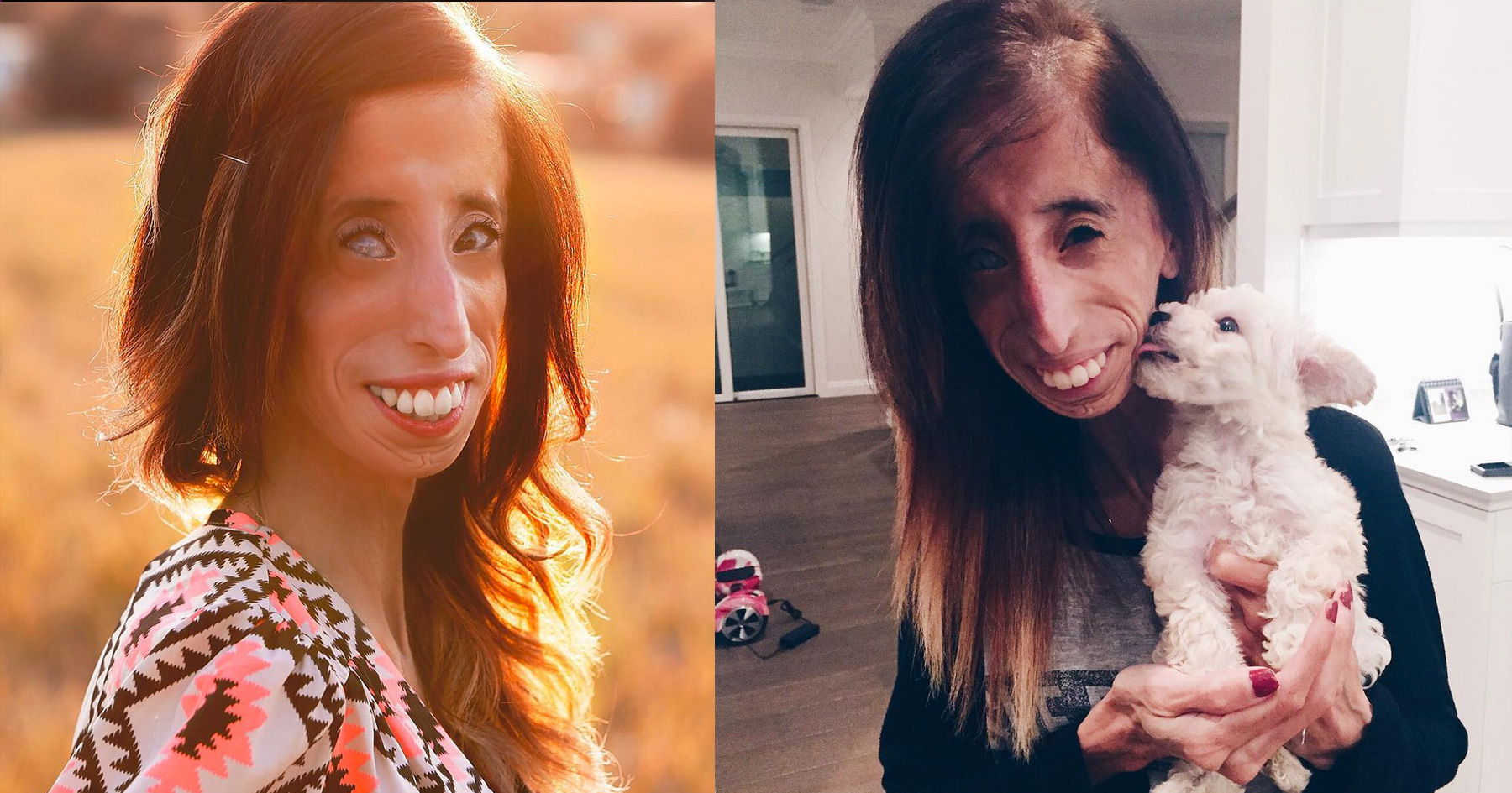 Lizzie Velasquezs Response To Being Called The Worlds Ugliest Woman 