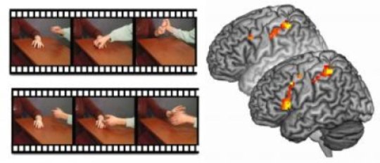 Netherlands Brain Imaging Film Study