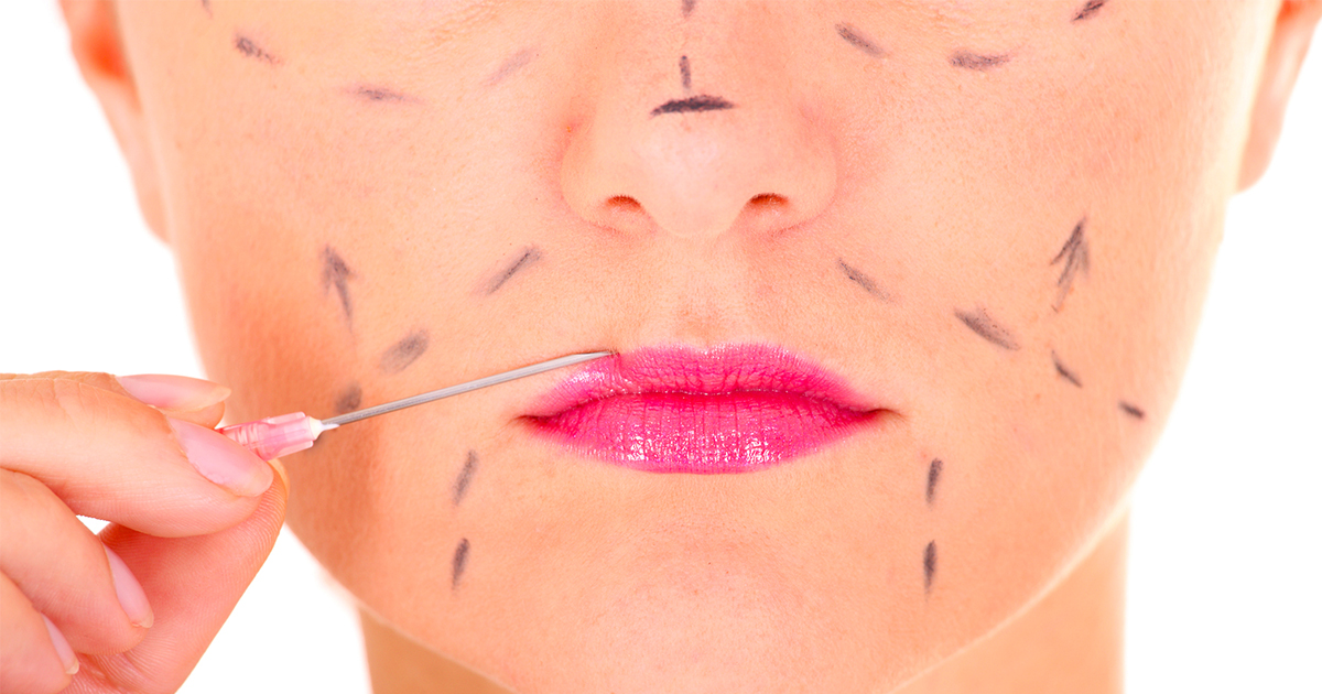 woman-with-markings-needle-on-face