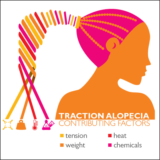 Risk factors that increase your chances of traction alopecia.
